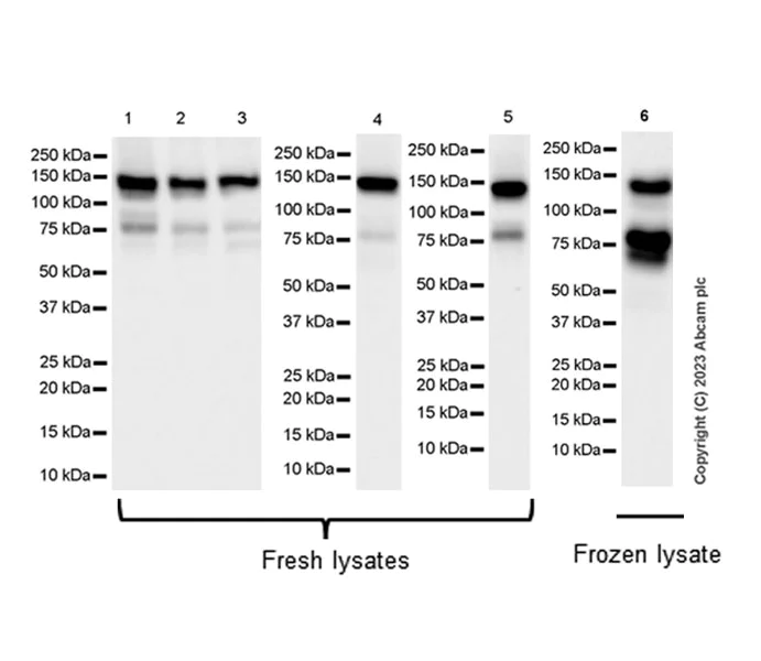 Western blot - Anti-ZCWCC1 antibody [EPR28655-56] (AB315903)