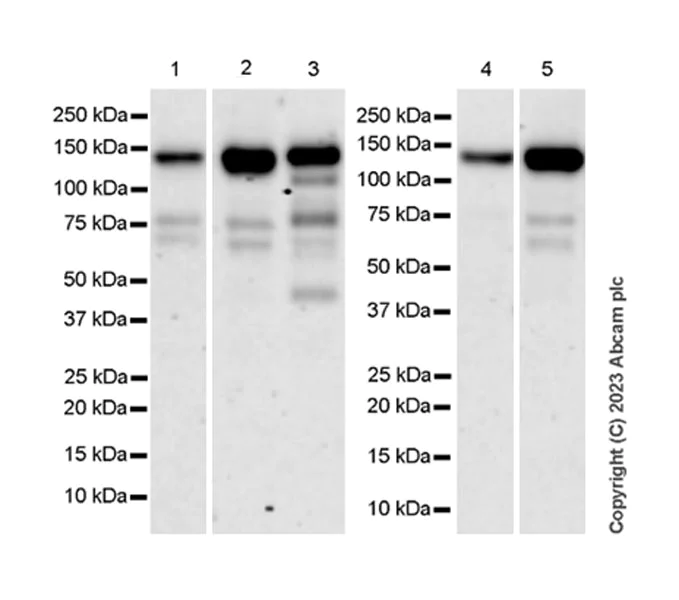 Western blot - Anti-ZCWCC1 antibody [EPR28655-56] (AB315903)