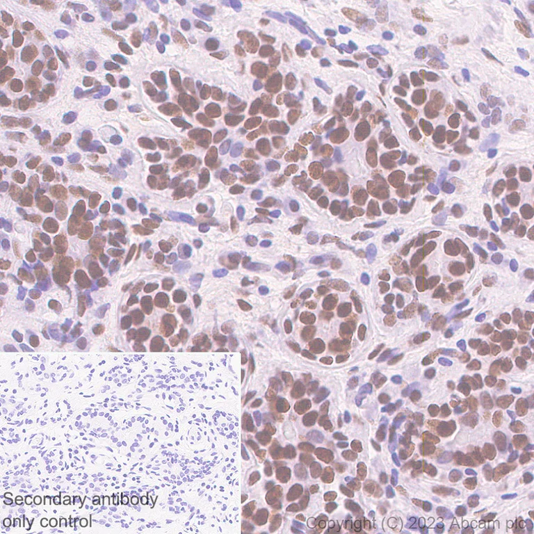 Immunohistochemistry (Formalin/PFA-fixed paraffin-embedded sections) - Anti-ZCWCC1 antibody [EPR28655-56] - BSA and Azide free (AB315904)