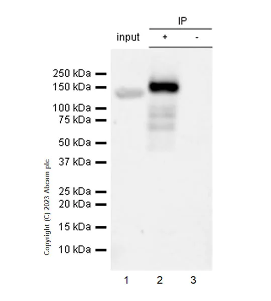 Immunoprecipitation - Anti-ZCWCC1 antibody [EPR28655-56] - BSA and Azide free (AB315904)