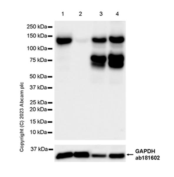 Western blot - Anti-ZCWCC1 antibody [EPR28655-56] - BSA and Azide free (AB315904)