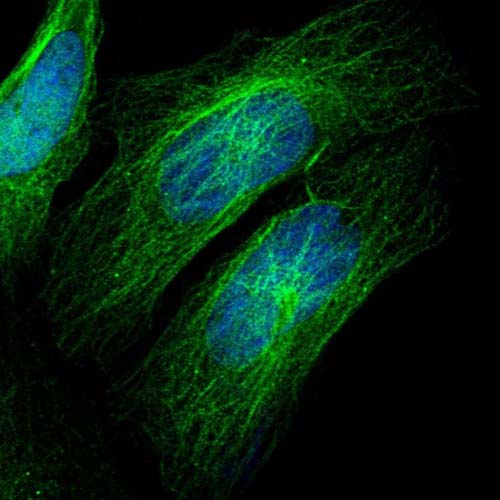 Immunocytochemistry/ Immunofluorescence - Anti-ZCWPW2 antibody (AB126482)