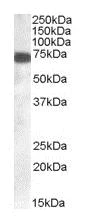 Western blot - Anti-ZDHHC13 antibody (AB28759)