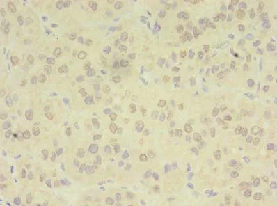 Immunohistochemistry (Formalin/PFA-fixed paraffin-embedded sections) - Anti-ZDHHC4/DC1 antibody (AB235369)