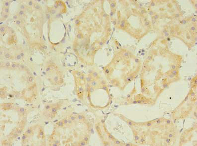 Immunohistochemistry (Formalin/PFA-fixed paraffin-embedded sections) - Anti-ZDHHC4/DC1 antibody (AB235369)