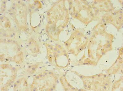 Immunohistochemistry (Formalin/PFA-fixed paraffin-embedded sections) - Anti-ZDHHC4/DC1 antibody (AB235369)
