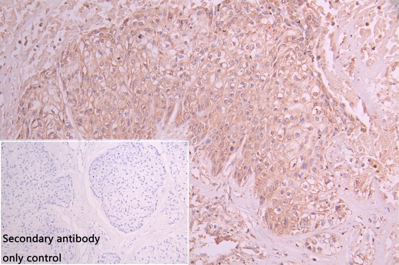 Immunohistochemistry (Formalin/PFA-fixed paraffin-embedded sections) - Anti-ZDHHC4/DC1 antibody (AB235369)