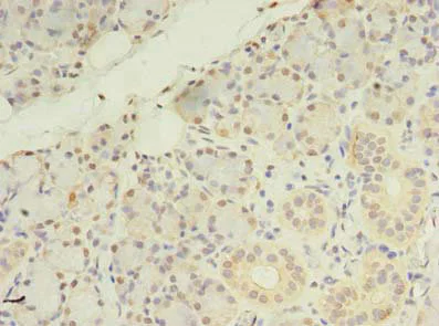Immunohistochemistry (Formalin/PFA-fixed paraffin-embedded sections) - Anti-ZDHHC4/DC1 antibody (AB235369)