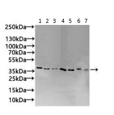 Western blot - Anti-ZDHHC4/DC1 antibody (AB235369)