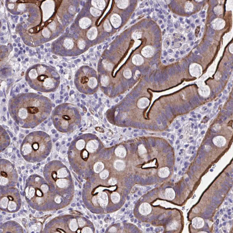 Immunohistochemistry (Formalin/PFA-fixed paraffin-embedded sections) - Anti-ZDHHC7 antibody (AB254954)