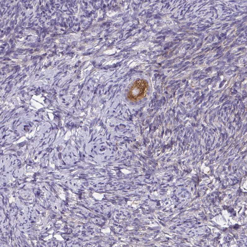 Immunohistochemistry (Formalin/PFA-fixed paraffin-embedded sections) - Anti-ZDHHC7 antibody (AB254954)