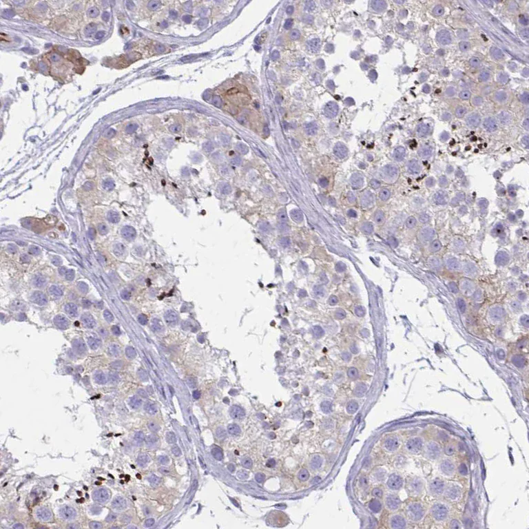 Immunohistochemistry (Formalin/PFA-fixed paraffin-embedded sections) - Anti-ZDHHC7 antibody (AB254954)