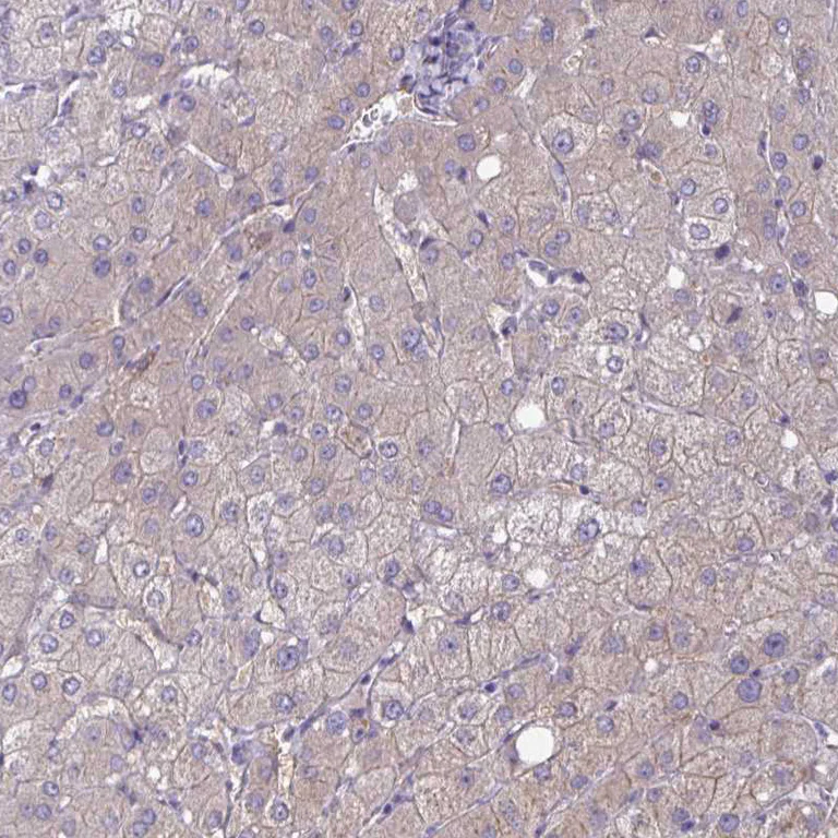 Immunohistochemistry (Formalin/PFA-fixed paraffin-embedded sections) - Anti-ZDHHC7 antibody (AB254954)
