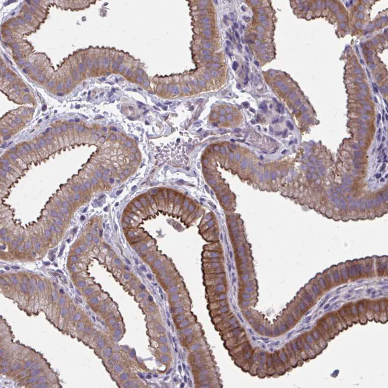 Immunohistochemistry (Formalin/PFA-fixed paraffin-embedded sections) - Anti-ZDHHC7 antibody (AB254954)