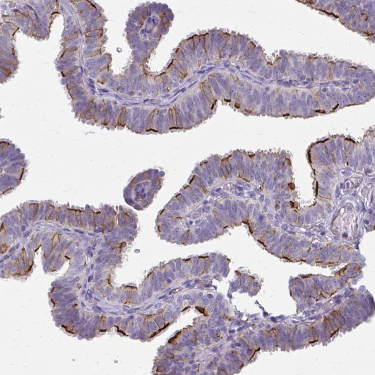 Immunohistochemistry (Formalin/PFA-fixed paraffin-embedded sections) - Anti-ZDHHC7 antibody (AB254954)