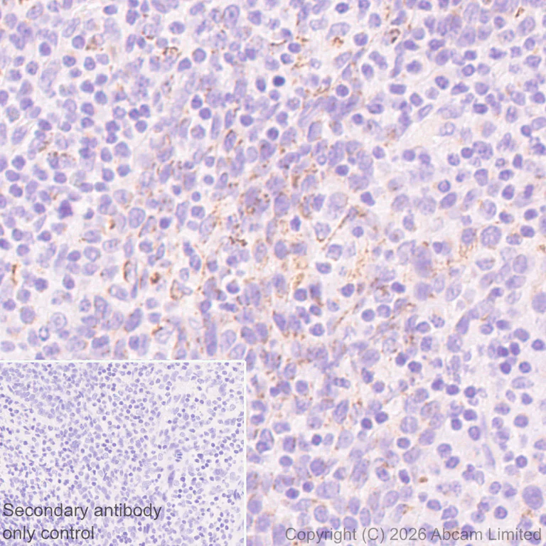 Immunohistochemistry (Formalin/PFA-fixed paraffin-embedded sections) - Anti-ZDHHC7 antibody [EPR30883-532] (AB327351)