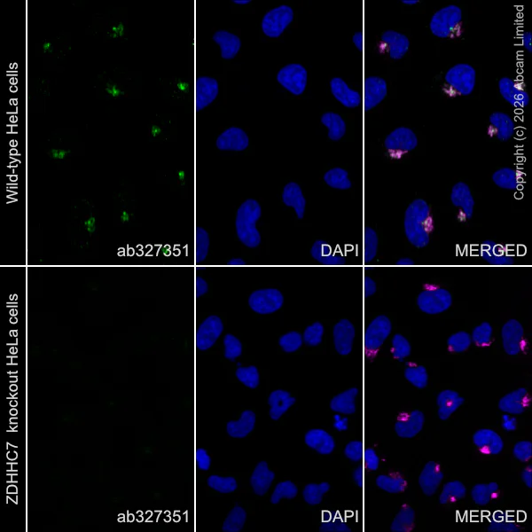 Immunocytochemistry/ Immunofluorescence - Anti-ZDHHC7 antibody [EPR30883-532] - BSA and Azide free (AB326972)