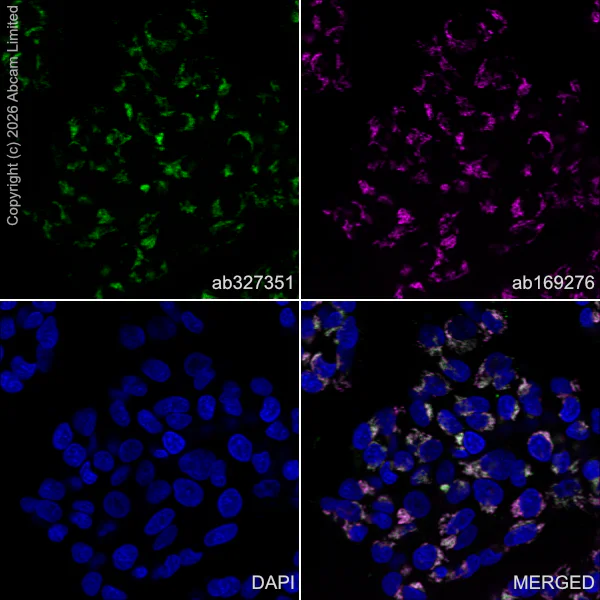 Immunocytochemistry/ Immunofluorescence - Anti-ZDHHC7 antibody [EPR30883-532] - BSA and Azide free (AB326972)