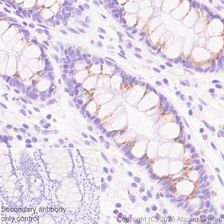 Immunohistochemistry (Formalin/PFA-fixed paraffin-embedded sections) - Anti-ZDHHC7 antibody [EPR30883-532] - BSA and Azide free (AB326972)