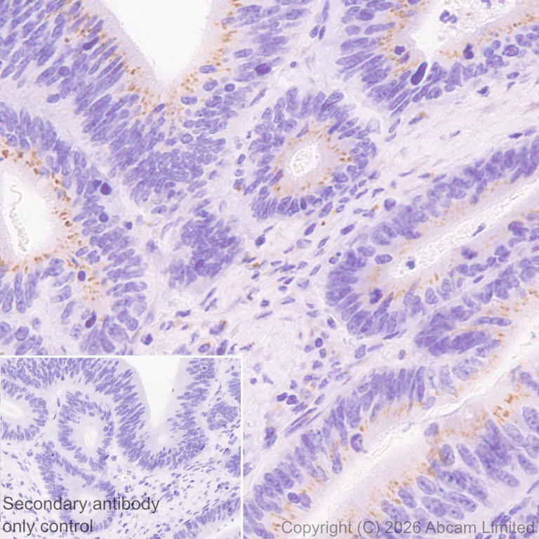 Immunohistochemistry (Formalin/PFA-fixed paraffin-embedded sections) - Anti-ZDHHC7 antibody [EPR30883-532] - BSA and Azide free (AB326972)
