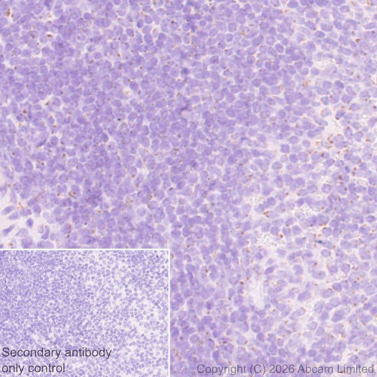 Immunohistochemistry (Formalin/PFA-fixed paraffin-embedded sections) - Anti-ZDHHC7 antibody [EPR30883-532] - BSA and Azide free (AB326972)