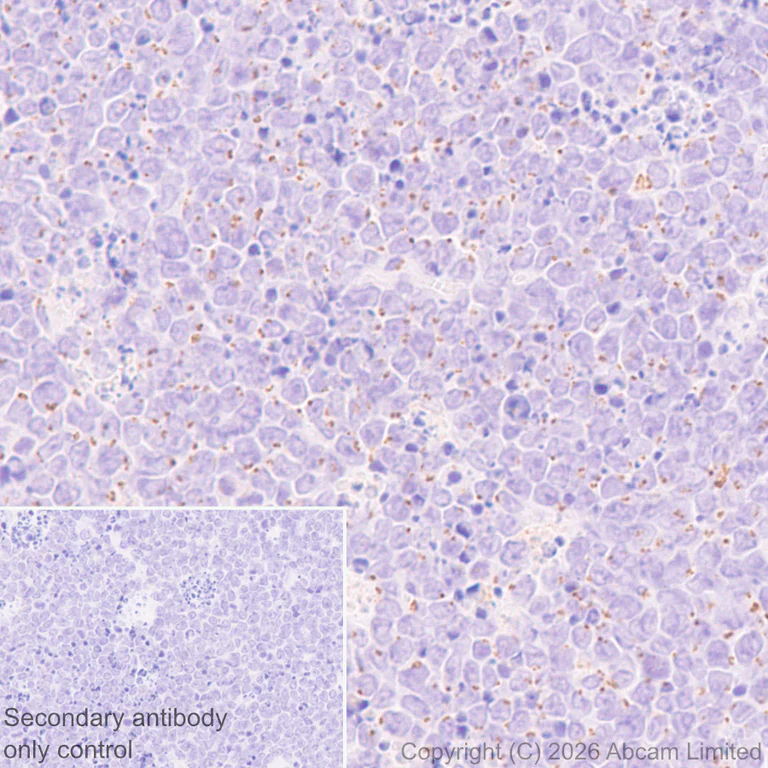 Immunohistochemistry (Formalin/PFA-fixed paraffin-embedded sections) - Anti-ZDHHC7 antibody [EPR30883-532] - BSA and Azide free (AB326972)