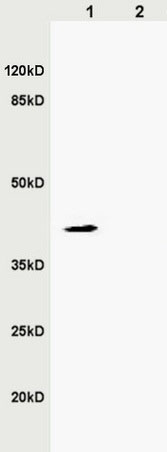 Western blot - Anti-ZDHHC9 antibody (AB217757)