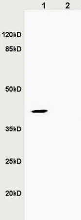 Western blot - Anti-ZDHHC9 antibody (AB217757)
