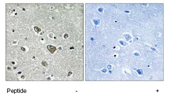 Immunohistochemistry (Formalin/PFA-fixed paraffin-embedded sections) - Anti-ZDHHC9 antibody (AB74504)
