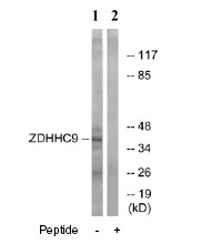Western blot - Anti-ZDHHC9 antibody (AB74504), expandable thumbnail