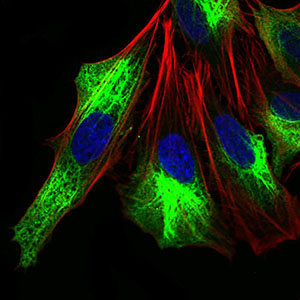Immunocytochemistry/ Immunofluorescence - Anti-ZEB1 antibody [2A8A6] (ab181451), expandable thumbnail