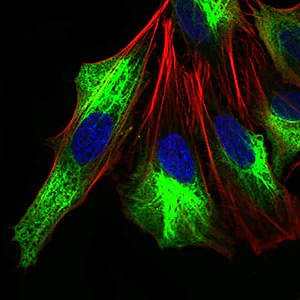 Immunocytochemistry/ Immunofluorescence - Anti-ZEB1 antibody [2A8A6] (AB181451)