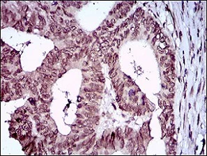 Immunohistochemistry (Formalin/PFA-fixed paraffin-embedded sections) - Anti-ZEB1 antibody [2A8A6] (AB181451)