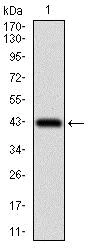 Western blot - Anti-ZEB1 antibody [2A8A6] (AB181451)