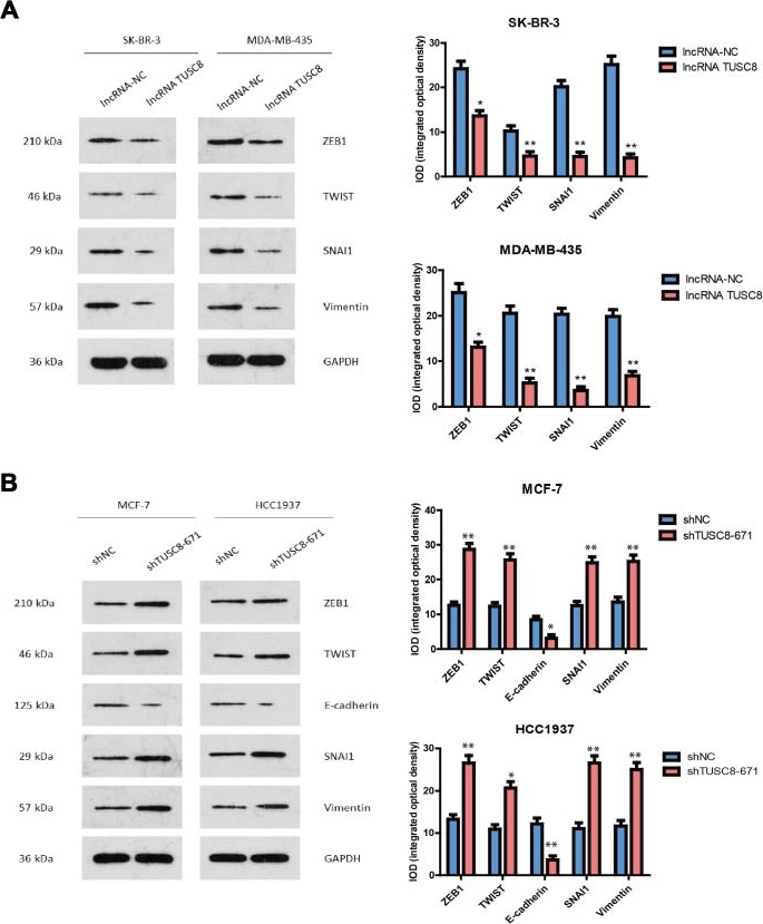 Western blot - Anti-ZEB1 antibody [2A8A6] (ab181451), expandable thumbnail