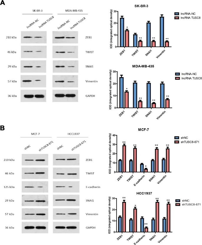Western blot - Anti-ZEB1 antibody [2A8A6] (AB181451)