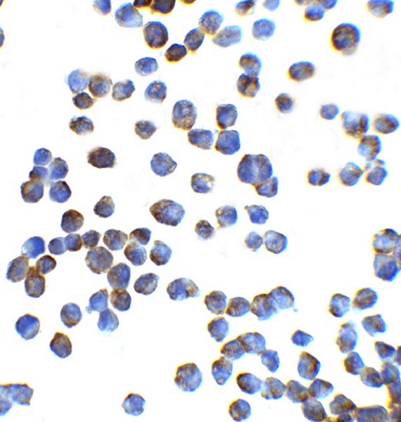 Immunocytochemistry - Anti-ZEB1 antibody (AB124512), expandable thumbnail