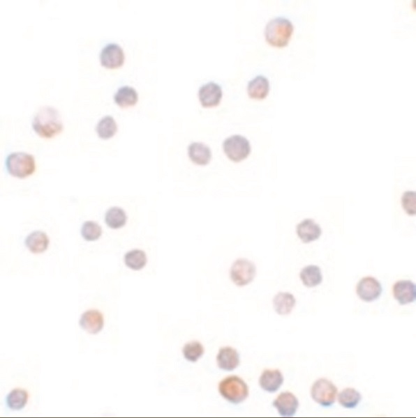 Immunocytochemistry - Anti-ZEB1 antibody (AB124512), expandable thumbnail