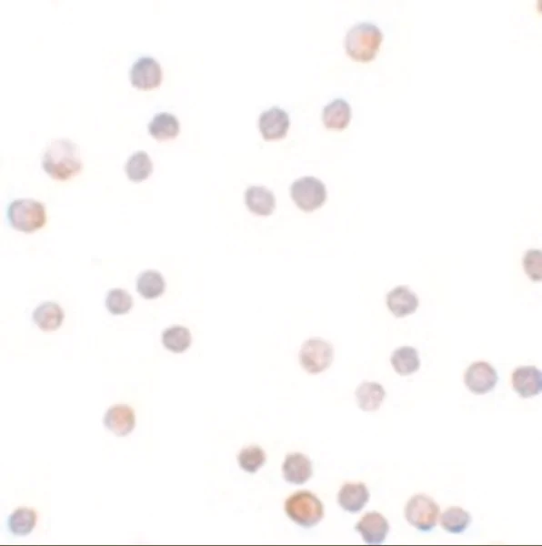 Immunocytochemistry - Anti-ZEB1 antibody (AB124512)