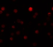 Immunocytochemistry/ Immunofluorescence - Anti-ZEB1 antibody (AB124512), expandable thumbnail