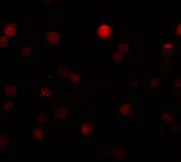 Immunocytochemistry/ Immunofluorescence - Anti-ZEB1 antibody (AB124512)