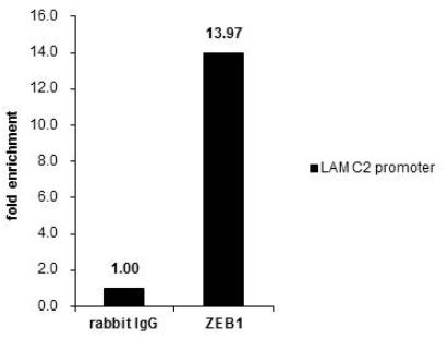 ChIP - Anti-ZEB1 antibody (AB155249), expandable thumbnail