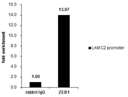 ChIP - Anti-ZEB1 antibody (AB155249)