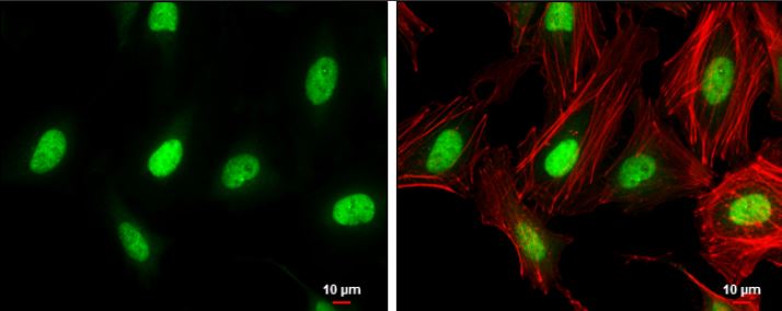 Immunocytochemistry/ Immunofluorescence - Anti-ZEB1 antibody (AB155249), expandable thumbnail