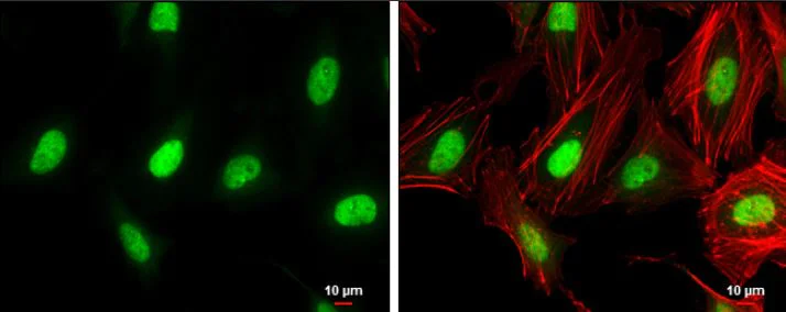 Immunocytochemistry/ Immunofluorescence - Anti-ZEB1 antibody (AB155249)