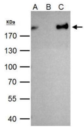 Immunoprecipitation - Anti-ZEB1 antibody (AB155249), expandable thumbnail