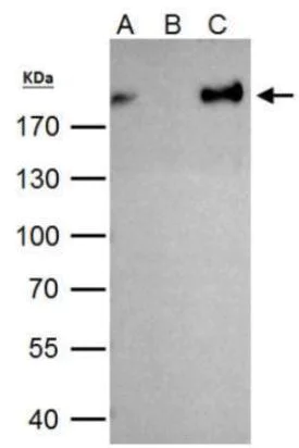 Immunoprecipitation - Anti-ZEB1 antibody (AB155249)