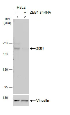Western blot - Anti-ZEB1 antibody (AB155249)