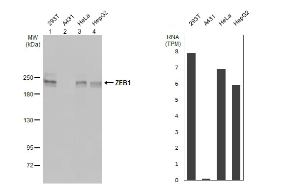 Western blot - Anti-ZEB1 antibody (AB155249)