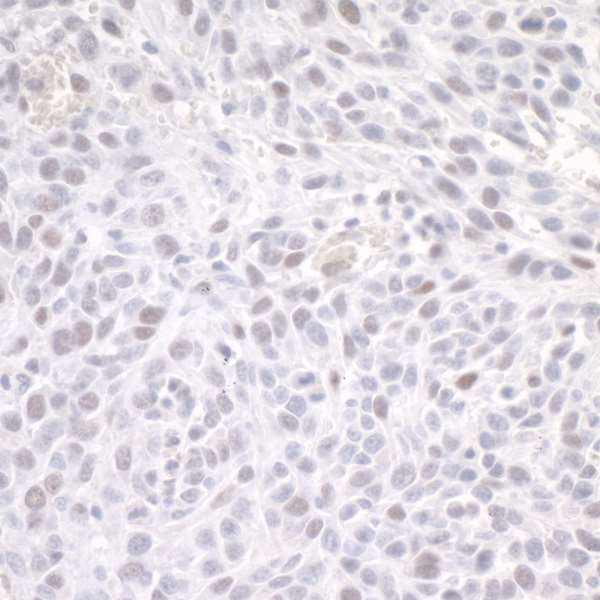 Immunohistochemistry (Formalin/PFA-fixed paraffin-embedded sections) - Anti-ZEB1 antibody (AB245283), expandable thumbnail